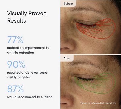 Micro-Infusion Patches