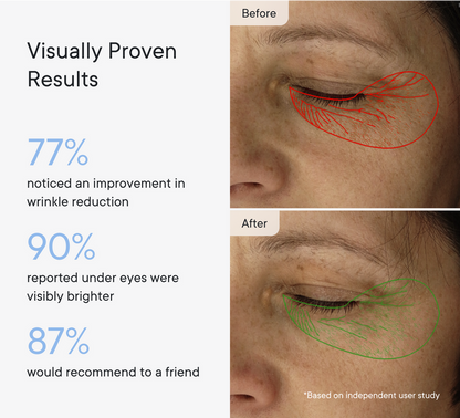Micro-Infusion Patches