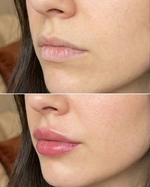 Extreme Lip Plumper