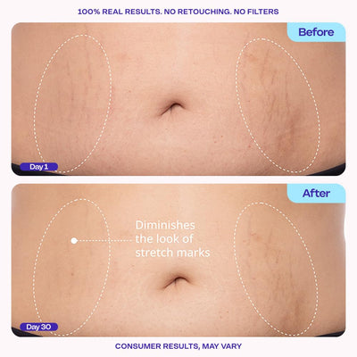 Tighten & Smooth Belly Cream