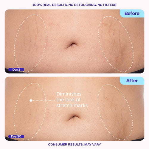 Tighten & Smooth Belly Cream